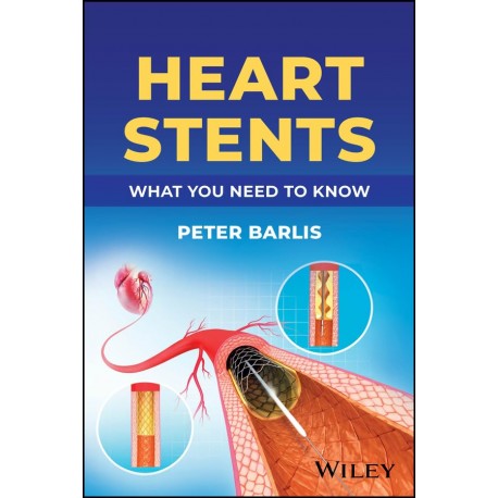 Heart Stents: What You Need to Know