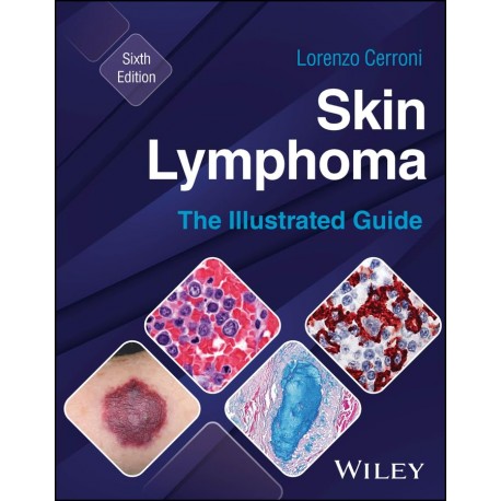 Skin Lymphoma: The Illustrated Guide, 6th Edition