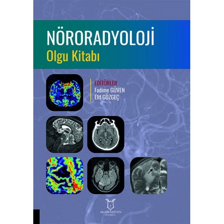 Nöroradyoloji Olgu Kitabı