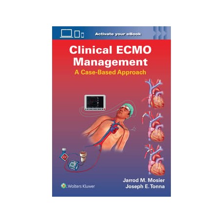 Clinical ECMO Management: A Case-Based Approach 