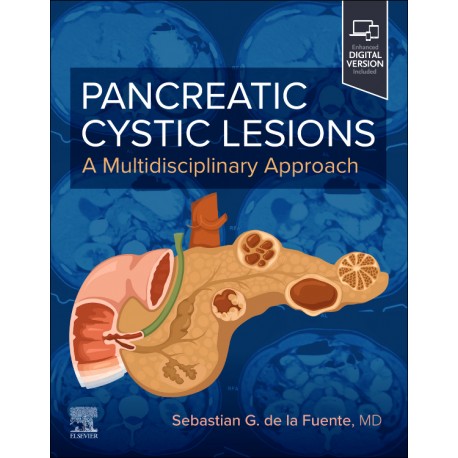 Pancreatic Cystic Lesions: A Multidisciplinary Approach A Multidisciplinary Approach