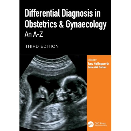 Differential Diagnosis in Obstetrics & Gynaecology An A-Z,3rd Edition