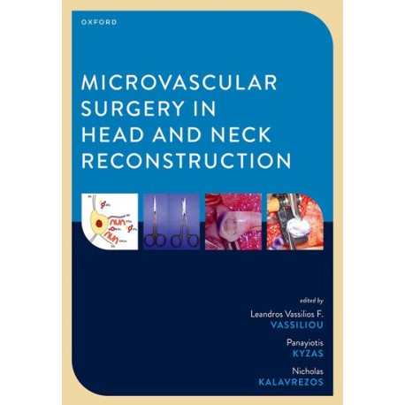 Microvascular Surgery in Head and Neck Reconstruction