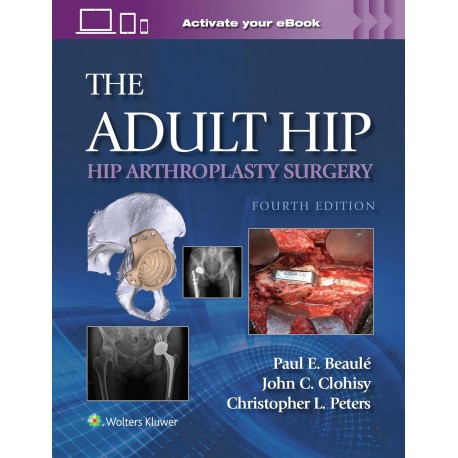 The Adult Hip: Hip Arthroplasty Surgery Print + eBook with Multimedia,4 Edition