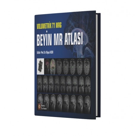 Volumetrik T1 MRG Beyin MR Atlası