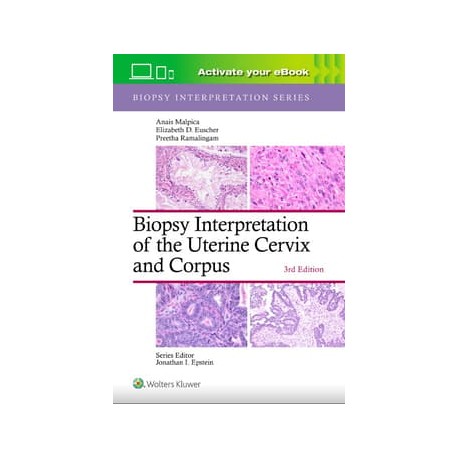 Biopsy Interpretation of the Uterine Cervix and Corpus: Print + eBook with Multimedia,3th Edition