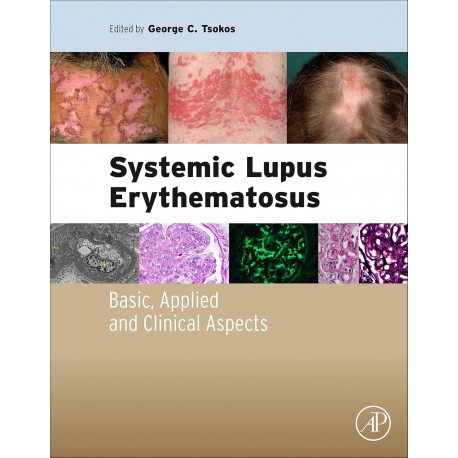 Systemic Lupus Erythematosus: Basic, Applied and Clinical Aspects