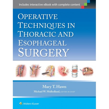 Operative Techniques in Thoracic and Esophageal Surgery