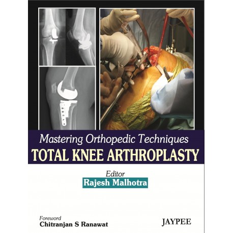 Mastering Orthopedic Techniques Total knee Arthroplasty