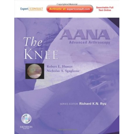 AANA Advanced Arthroscopy: The Knee: Expert Consult: Online, Print and DVD