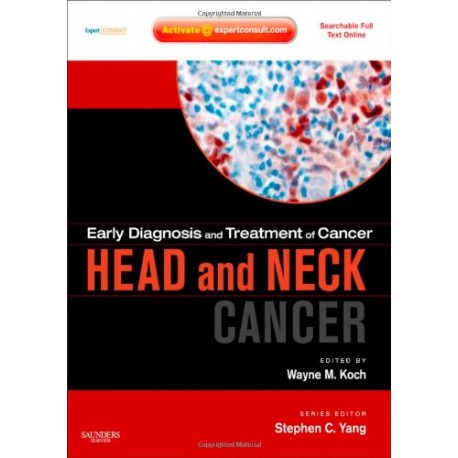 Early Diagnosis and Treatment of Cancer Series: Head and Neck Cancers: Expert Consult - Online and Print