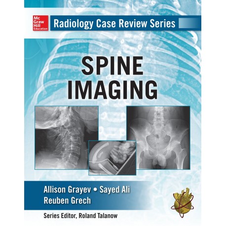 Radiology Case Review Series: Spine
