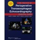 The Practice of Perioperative Transesophageal Echocardiography: Essential Cases 1st Edition