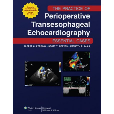 The Practice of Perioperative Transesophageal Echocardiography: Essential Cases 1st Edition