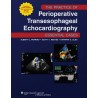 The Practice of Perioperative Transesophageal Echocardiography: Essential Cases 1st Edition