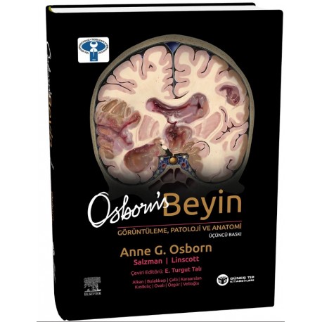 Osborn's Beyin Görüntüleme, Patoloji ve Anatomi 3. Baskı