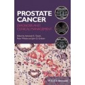 Prostate Cancer : Diagnosis and Clinical Management