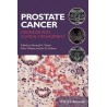 Prostate Cancer : Diagnosis and Clinical Management