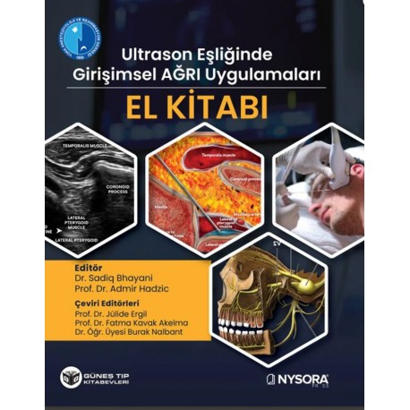 NYSORA - Ultrason Eşliğinde Girişimsel Ağrı Uygulamaları El Kitabı (Video Destekli)