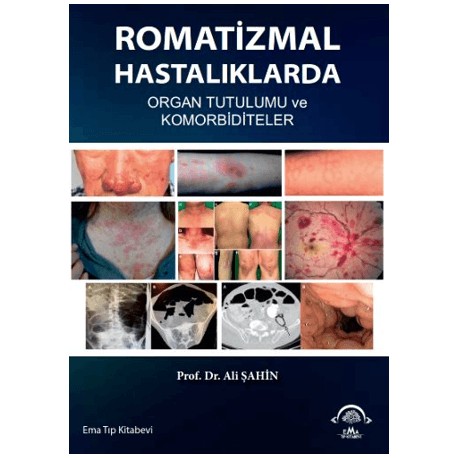 Romatizmal Hastalıklarda Organ Tutulumu ve Komorbiditeler