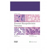 Prostat Biyopsilerinin Yorumu