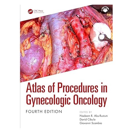 Atlas of Procedures in Gynecologic Oncology,4th Edition