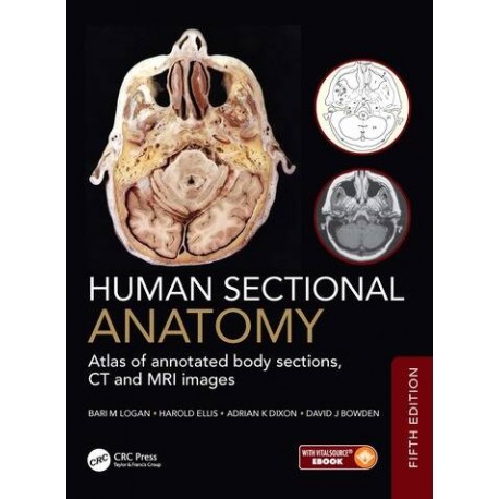 Human Sectional Anatomy Atlas of annotated body sections, CT and MRI images,5th Edition
