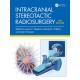 Intracranial Stereotactic Radiosurgery,4th Edition