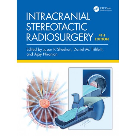 Intracranial Stereotactic Radiosurgery,4th Edition