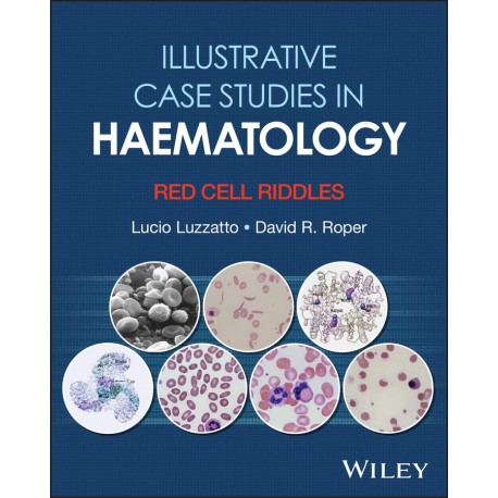 Illustrative Case Studies in Haematology: Red Cell Riddles