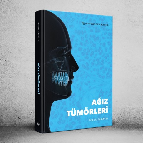 Ağız Tümörleri