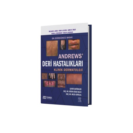 Andrews Deri Hastalıkları
