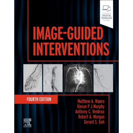 Image-Guided Interventions, 4th Edition