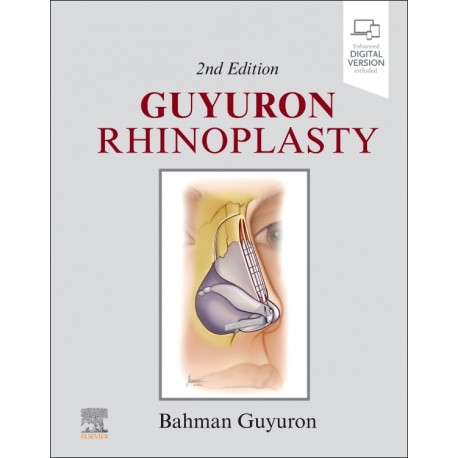 Guyuron Rhinoplasty, 2nd Edition