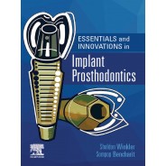 Essentials and Innovations in Implant Prosthodontics