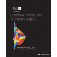 How to Perform Operative Procedures in Breast Surgery